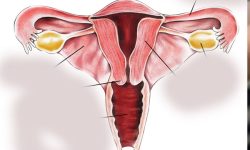 पाठेघरको क्यान्सरबाट यसरी बच्न सकिन्छ