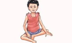 कुपोषण विरुद्ध नेपालले यसरी हात पार्दै छ सफलता, यस्तो हुनेछ आजको विश्व सम्मेलनमा !