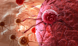 क्यान्सरका लक्षण र त्यसका रोकथामका उपाय