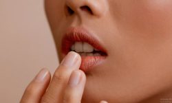 ओंठ फुट्ने समस्याले सताएको छ ? यस्ता छन बच्ने उपाय