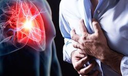 हृदयघात हुनुका कारण, लक्षण र यसको उपचार