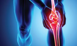 घुँडा दुखाईको समस्या छ ? बच्न यी ५ खानेकुरा खानुहोस्