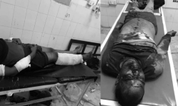 धनुषा बम काण्डः साहको हत्या गर्ने उद्देश्यले बम राखिएको अनुमान