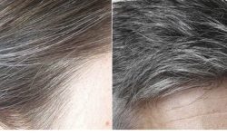 उमेर नपुगी कपाल फुले के गर्ने ?