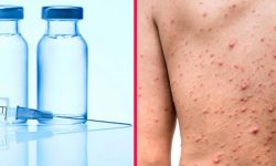 बैतडीका २७ हजार बालबालिकालाई दादुरा–रुबेला विरुद्धको खोप लगाइदैँ