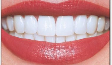 यसरी घरेलु उपायले नै सजिलै चम्काउन सकिन्छ दाँत