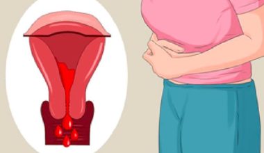 महिनावारीको समयमा भुलेर पनि खानु हुदैन यी खाने कुराहरु