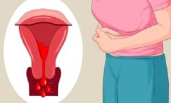 महिनावारीको समयमा भुलेर पनि खानु हुदैन यी खाने कुराहरु