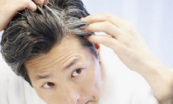 कपाल फुल्ने कारण र फुल्नै नदिने उपायहरु