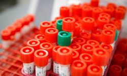 कोरोना भाइरस परीक्षणको दायरा बढाउन माग