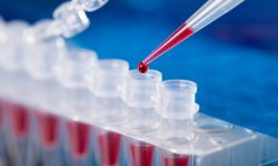 प्रयोगशालाबाटै कोरोना स्वाब नमुना हरायो