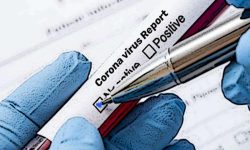 स्थानिय तहका ४ सय ८८ को रिपोर्ट नेगेटिभ