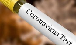 किट अभावको  कोरोना परीक्षणमा समस्या