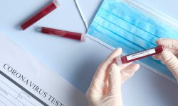 काठमाडौँमा १ महिला र १ पुरुषमा कोरोना पुष्टी, अपार्टमेन्टका सबैको कोरोना परिक्षण हुने