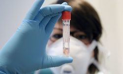 संक्रमितको अवस्था सामान्य