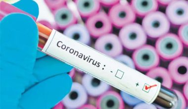 नेपालगन्जमा संक्रमितको सम्पर्कमा रहेका तीन सय जनाको ‘कन्ट्याक्ट ट्रेसिङ’