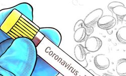 आरडिटी पोजेटिभपछि शङ्खरापुर सिल