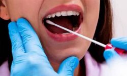 इलाममा हप्ताकाे दुई दिन मात्र स्वाब सङ्कलन