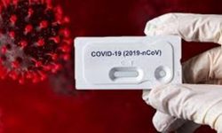 कोरोना : विश्वमा संक्रमितको संख्या झण्डै ६७ लाख पुग्यो, अमेरिकामा एक लाख १० हजारको मृत्यु