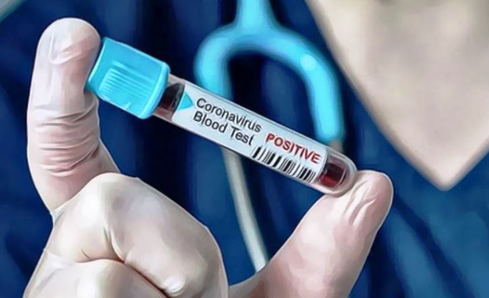 थप दुईजनाले आज कोरोना जिते