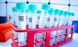 प्रदेश ५ सरकारद्वारा कोरोना परीक्षण किट र पीपीई माग