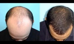 तामा भन्दा कपाल बलियो हुन्छ ! कपालको बारेमा केही रोचक कुराहरु