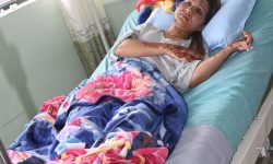 तेजाब प्रहारबाट घाइते युवतीलाई स्वास्थ्यमन्त्रीले भने, ‘उपचारमा सरकारले सहयोग गर्छ’