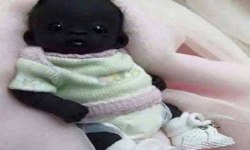 संसारकै सबैभन्दा कालो बच्चा