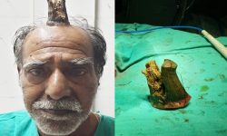 मानिसको सिंग पलाएपछि…