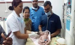 दुई टाउको र तीन हात भएको अनौठो बच्चा जन्मियो !