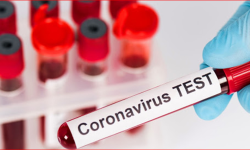 पिसीआर परीक्षणमा कालोबजारी गरेको अरोपमा सरकारीसहित दुई अस्पताल कारवाहीमा