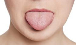 युवतीको जिब्रोको मूल्य १६ करोड तोकियो