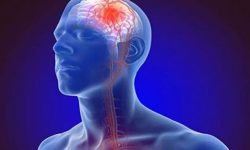 राष्ट्रियसभाका पूर्वसदस्य विदुर पौडेललाई  मष्तिष्काघात