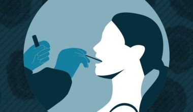 कोरोनाको जाँचमा टेस्ट किटको तुलनामा कुकुर बढी प्रभावकारी