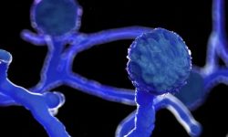 कोरोना संक्रमितमा आँखा बिगार्ने घातक कालो ढुसीको सङ्क्रमण देखा पर्न थाल्यो