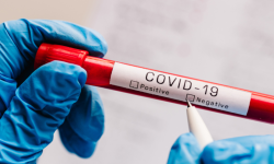 चितवनमा कोरोना सङ्क्रमित घट्दो क्रममा