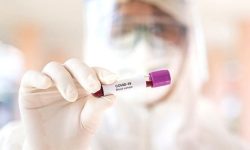 आज काठमाडौं उपत्यकामा कति संक्रमित थपिए ?