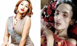 निशा घिमिरे : भेन्टिलेटरमा पुगेर फर्किन्, अवस्थामा सुधार