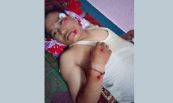 खबपु दुर्घटनामा, अवस्था खतरामुक्त