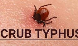 उत्तर प्रदेशमा देखियो स्क्रब टाइफस