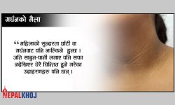 गर्धनको मैलो यसरी सफा गर्नुस्…