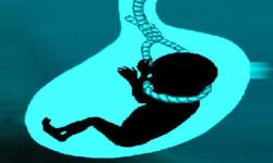 सर्लाहीमा महिलाको जनसंख्या घट्दो : लिङ्ग पहिचान गर्दै भ्रूण हत्या