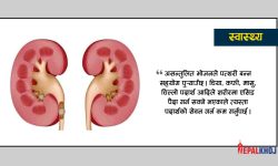 पत्थरी भए के खाने के नखाने ?