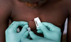 नेपालीको श्रम गन्तव्य युएईमा मंकिपक्स संक्रमण