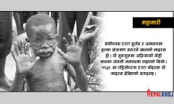 बढ्यो मंकीपक्स भाइरसको त्रास, लक्षण तथा रोकथामका उपाय यस्ता !