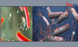 १७ जनामा हैजा पुष्टि, स्वास्थ्य मन्त्रालयले भन्यो- सजगता अपनाउनू