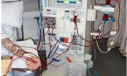 डायलायसिस मेसिन आयो, जडान भएन