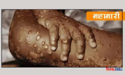 मंकीपक्सको नयाँ भेरियन्टको नामकरण