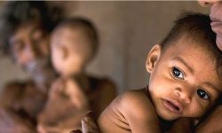 सोमालियामा बालबालिकामा कुपोषणको समस्या झन् बढ्ने