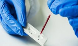 जापानले अल्जाइमरको रगत परीक्षण किटलाई दियाे स्वीकृत